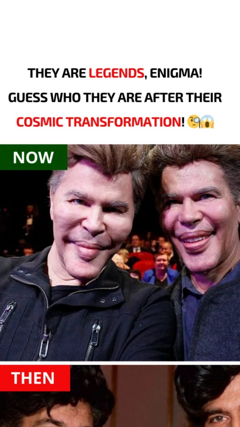 Due to numerous plastic surgeries, these brothers have severely altered their appearance. What did they look like before?