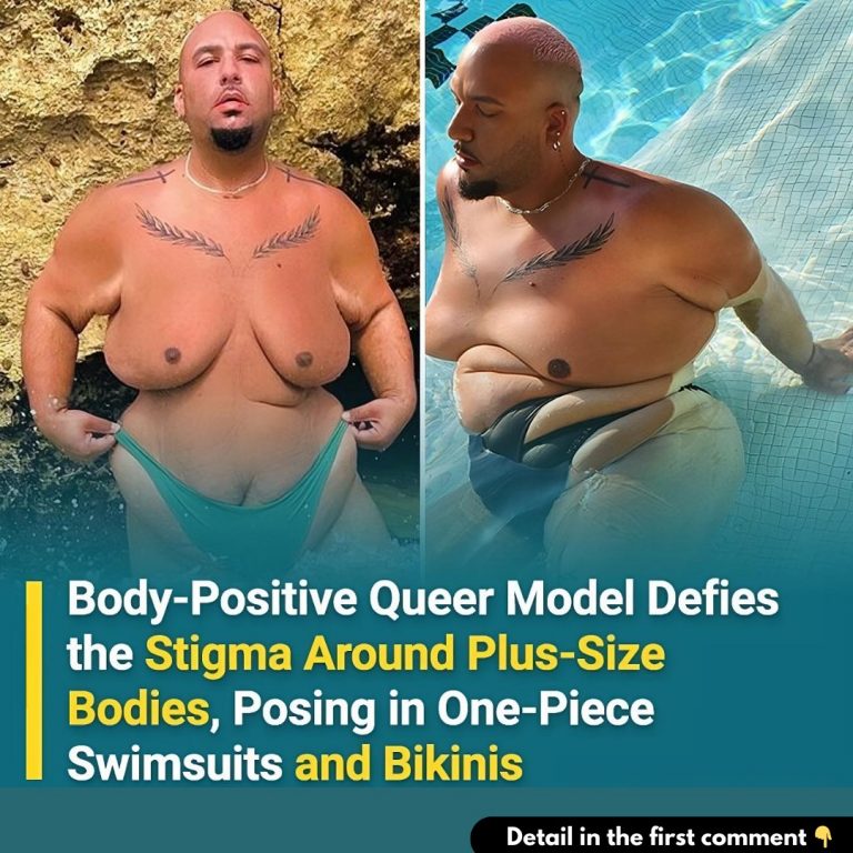 Body-Positive Queer Model Defies the Stigma Around Plus-Size Bodies, Posing in One-Piece Swimsuits and Bikinis