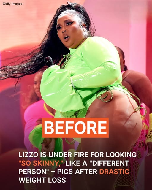 Users Say Singer Lizzo Looks ‘So Skinny,’ Like a ‘Different Person’ — Her Pics Before & After Drastic Weight Loss