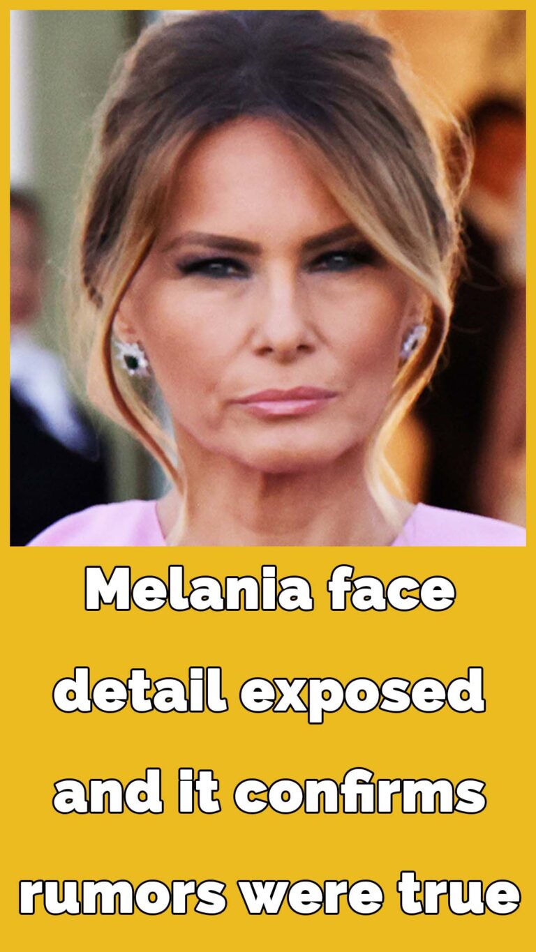 Expert shares insight into Melania Trump’s beauty routine